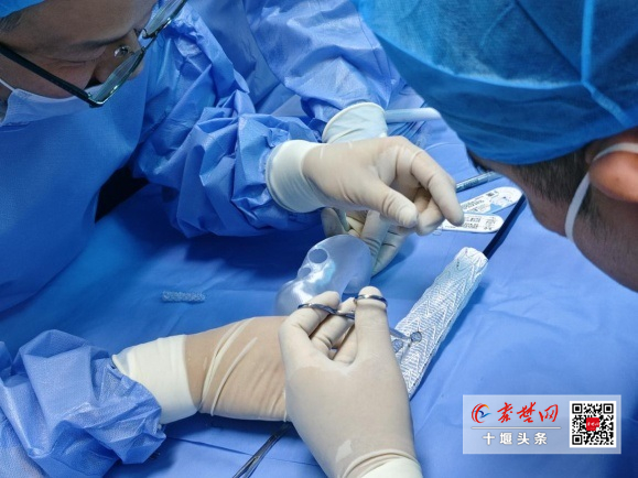 3D打印技術助力復雜手術，十堰人醫為89歲高齡患者拆除動脈瘤